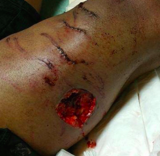 Illustration for article titled Norfolk State University Student Brutally Attacked by Police Dog